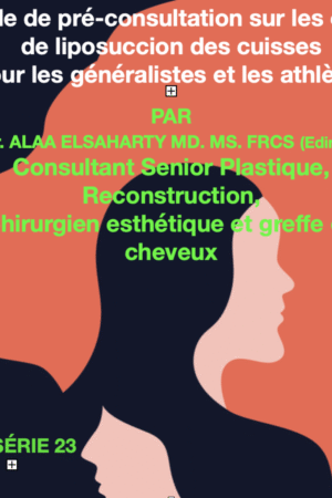 Liposuccion des cuisses et alternatives